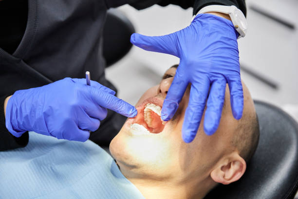 Best Emergency Dental Care for Sports Injuries in Flemington, GA